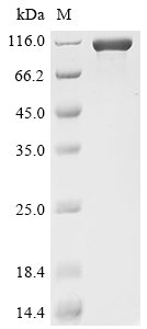 Recombinant Mouse Cadherin-17 (Cdh17), partial, Mus musculus (Mouse), Mammalian cell, C-terminal 10xHis-tagged, 85.7kDa, purity >90% as determined by SDS-PAGE.
