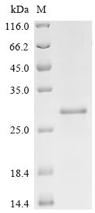 Recombinant Mouse Cyclin-dependent kinase inhibitor 1 (Cdkn1a), Mus musculus (Mouse), E.coli, C-terminal 6xHis-tagged, 24.7kDa, purity >95% as determined by SDS-PAGE.