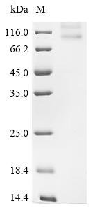 Recombinant Human Potassium voltage-gated channel subfamily KQT member 1 (KCNQ1) Protein, Homo sapiens (Human), in vitro E.coli expression system, N-terminal 10xHis-tagged, 80.7kDa, purity >90% as determined by SDS-PAGE.