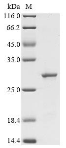 Recombinant Escherichia coli Cytolethal distending toxin subunit C (cdtC)