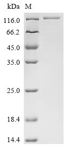 Recombinant Mouse Carcinoembryonic antigen-related cell adhesion molecule 5 (Ceacam5), Mus musculus (Mouse), Mammalian cell, C-terminal 10xHis-tagged, 104kDa, purity >85% as determined by SDS-PAGE.