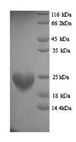 Recombinant Mouse Histone H3-like centromeric protein A (Cenpa), Mus musculus (Mouse), Yeast, N-terminal 6xHis-tagged, 17.5kDa, purity >90% as determined by SDS-PAGE.