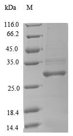 Recombinant Rat Complement factor D (Cfd), Rattus norvegicus (Rat), E.coli, N-terminal 10xHis-tagged and C-terminal Myc-tagged, 30.8kDa, purity >90% as determined by SDS-PAGE.