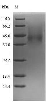 Recombinant Rat Complement factor D (Cfd), Rattus norvegicus (Rat), Yeast, N-terminal 6xHis-tagged, 27.8kDa, purity >90% as determined by SDS-PAGE.