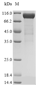 Recombinant Mouse Complement factor I (Cfi), Mus musculus (Mouse), Mammalian cell, N-terminal 10xHis-tagged and C-terminal Myc-tagged, 69.8kDa, purity >85% as determined by SDS-PAGE.