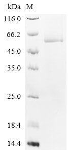 Recombinant Rat Serine/threonine-protein kinase Chk1 (Chek1), Rattus norvegicus (Rat), Baculovirus, C-terminal 6xHis-tagged, 57.2kDa, purity >85% as determined by SDS-PAGE.
