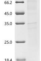 (Tris-Glycine gel) Discontinuous SDS-PAGE (reduced) with 5% enrichment gel and 15% separation gel.