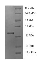 Recombinant Mouse Acetylcholine receptor subunit alpha (Chrna1), partial