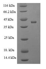Recombinant Mouse Acetylcholine receptor subunit alpha (Chrna1), partial