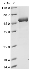 Recombinant Mouse Creatine kinase M-type (Ckm)