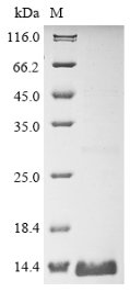 Recombinant Rat Claudin-1 (Cldn1), partial, Rattus norvegicus (Rat), E.coli, N-terminal 10xHis-tagged and C-terminal Myc-tagged, 13.4kDa, purity >90% as determined by SDS-PAGE.
