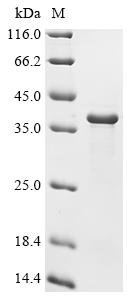 Recombinant Rabbit Methylosome subunit pICln (CLNS1A), Oryctolagus cuniculus (Rabbit), E.coli, N-terminal 10xHis-tagged and C-terminal Myc-tagged, 33.4kDa, purity >90% as determined by SDS-PAGE.