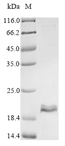 Recombinant Acetoanaerobium sticklandii Ferredoxin (CLOST_2292)