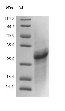 Recombinant Mouse Collagen alpha-2 (IV) chain (Col4a2), partial, Mus musculus (Mouse), E.coli, N-terminal 6xHis-tagged, 29.1kDa, purity >85% as determined by SDS-PAGE.