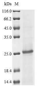 Recombinant Human Lecithin retinol acyltransferase (LRAT) Protein, Homo sapiens (Human), in vitro E.coli expression system, Tag-Free, 25.8kDa, purity >85% as determined by SDS-PAGE.