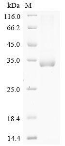 Recombinant Mouse Collagen alpha-3 (IV) chain (Col4a3), partial