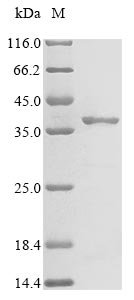 Recombinant Clostridium perfringens Microbial collagenase (colA), partial, Clostridium perfringens (strain 13 / Type A), E.coli, N-terminal 10xHis-tagged and C-terminal Myc-tagged, 39.7kDa, purity >85% as determined by SDS-PAGE.