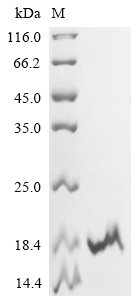 Recombinant Mouse Cytochrome c oxidase subunit 4 isoform 1, mitochondrial (Cox4i1), partial, Mus musculus (Mouse), E.coli, C-terminal 6xHis-tagged, 15.6kDa, purity >95% as determined by SDS-PAGE.
