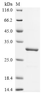 Recombinant Mouse Cytochrome c oxidase subunit 5A, mitochondrial (Cox5a)