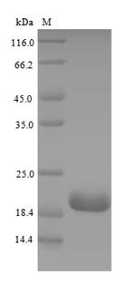 Recombinant Mouse Complement receptor type 2 (Cr2), partial, Mus musculus (Mouse), E.coli, N-terminal 6xHis-tagged, 18.7kDa, purity >90% as determined by SDS-PAGE.