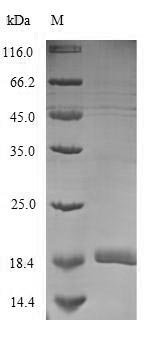 Recombinant Mouse Complement receptor type 2 (Cr2), partial, Mus musculus (Mouse), Mammalian cell, N-terminal 6xHis-Myc-tagged, 18.7kDa, purity >90% as determined by SDS-PAGE.