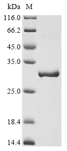 Recombinant Bovine Alpha-crystallin B chain (CRYAB)