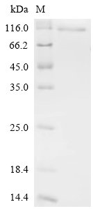 Recombinant Mouse Cold shock domain-containing protein E1 (Csde1)