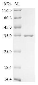 Recombinant Escherichia coli O157:H7 Curli production assembly/transport component CsgG (csgG)