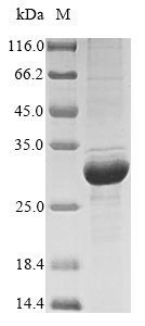 Recombinant Bovine Beta-casein (CSN2)
