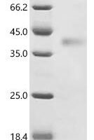 (Tris-Glycine gel) Discontinuous SDS-PAGE (reduced) with 5% enrichment gel and 15% separation gel.