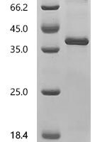 (Tris-Glycine gel) Discontinuous SDS-PAGE (reduced) with 5% enrichment gel and 15% separation gel.