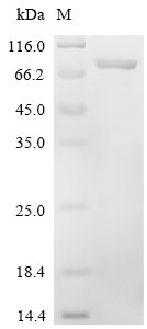 Recombinant Mouse CTP synthase 2 (Ctps2), Mus musculus (Mouse), E.coli, N-terminal 6xHis-tagged, 71.5kDa, purity >90% as determined by SDS-PAGE.