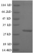 Recombinant Mouse Cathepsin K (Ctsk)
