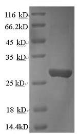 Recombinant Rat Cathepsin K (Ctsk)