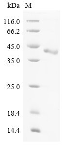 Recombinant Rat Cathepsin Z (Ctsz)