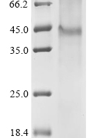 (Tris-Glycine gel) Discontinuous SDS-PAGE (reduced) with 5% enrichment gel and 15% separation gel.