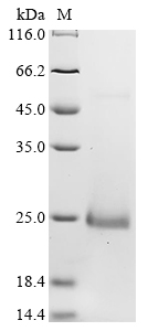 Recombinant Mouse C-X-C motif chemokine 15 (Cxcl15), Mus musculus (Mouse), E.coli, N-terminal 10xHis-tagged and C-terminal Myc-tagged, 23.8kDa, purity >90% as determined by SDS-PAGE.
