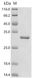 Recombinant Rat Cytoglobin (Cygb)