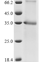 (Tris-Glycine gel) Discontinuous SDS-PAGE (reduced) with 5% enrichment gel and 15% separation gel.
