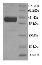 Recombinant Saccharomyces cerevisiae Cystathionine beta-synthase (CYS4), partial