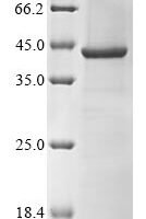 (Tris-Glycine gel) Discontinuous SDS-PAGE (reduced) with 5% enrichment gel and 15% separation gel.