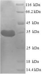 Recombinant Staphylococcus aureus Peptide deformylase (def)