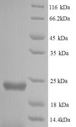 Recombinant Staphylococcus aureus Peptide deformylase (def)