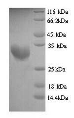 Recombinant Pongo pygmaeus Beta-defensin 126 (DEFB126), partial