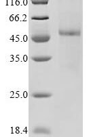(Tris-Glycine gel) Discontinuous SDS-PAGE (reduced) with 5% enrichment gel and 15% separation gel.