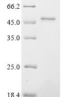 (Tris-Glycine gel) Discontinuous SDS-PAGE (reduced) with 5% enrichment gel and 15% separation gel.