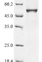 (Tris-Glycine gel) Discontinuous SDS-PAGE (reduced) with 5% enrichment gel and 15% separation gel.