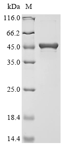 Recombinant Aggregatibacter actinomycetemcomitans Beta-N-acetylhexosaminidase (dspB)