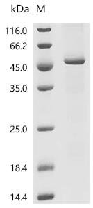 Recombinant Human Transmembrane protease serine 3 (TMPRSS3) Protein, Homo sapiens (Human), in vitro E.coli expression system, N-terminal 10xHis-tagged, 50.9kDa, purity >85% as determined by SDS-PAGE.