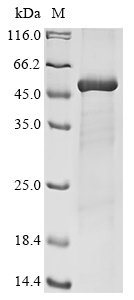 Recombinant Gossypium mustelinum BHLH domain-containing protein (E1A91_A07G086500v1)